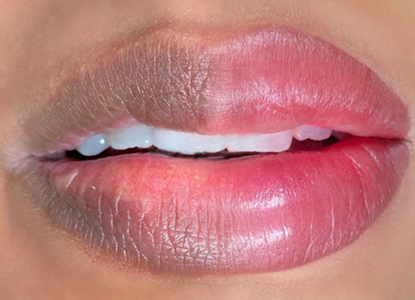 Lip Neutralization