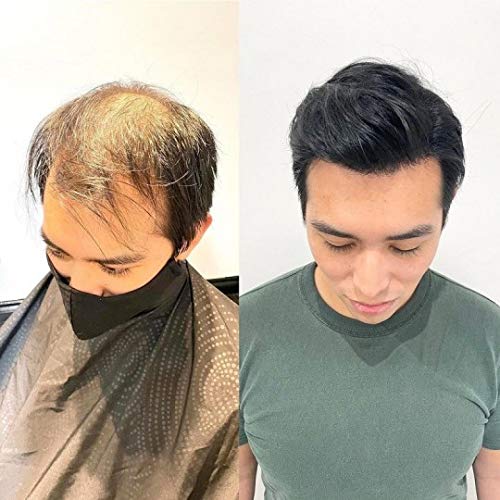 Mirage hair patches